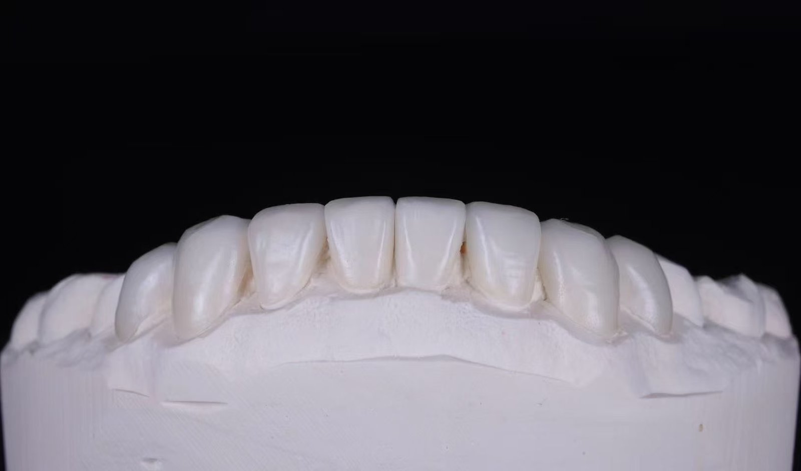 RDL dental restoration example 3