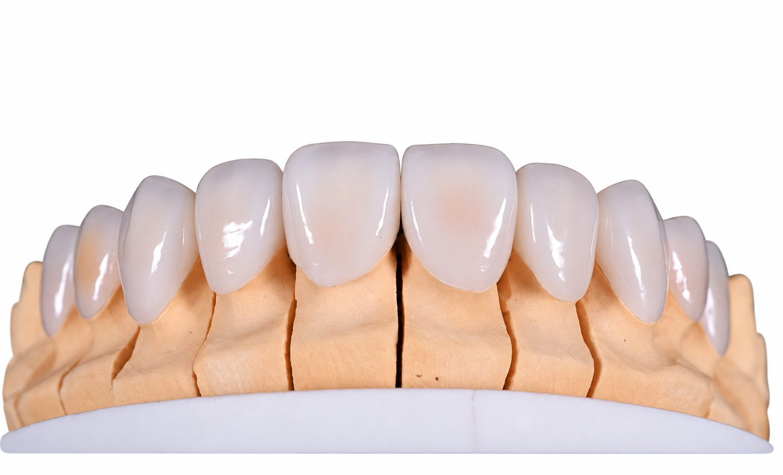 RDL Dental Lab Veneer product example