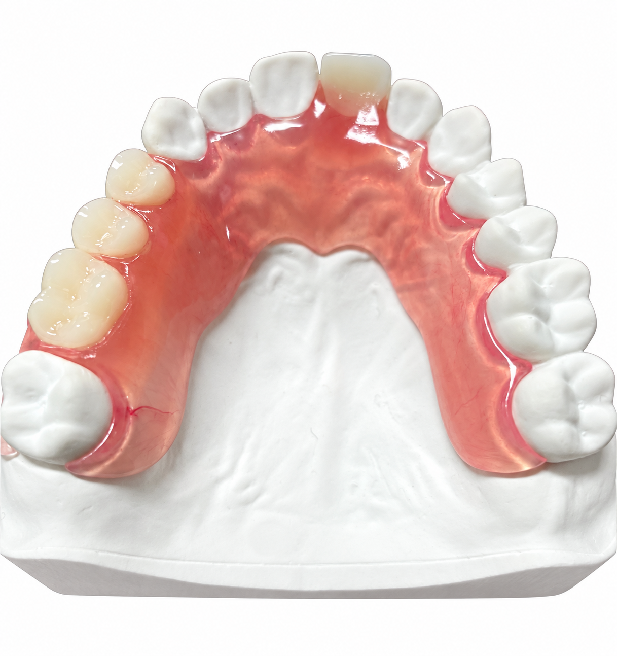 RDL Dental Lab Valplast product example