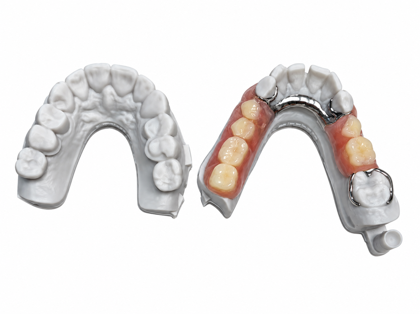 RDL Dental Lab Co-Cr Framework product example