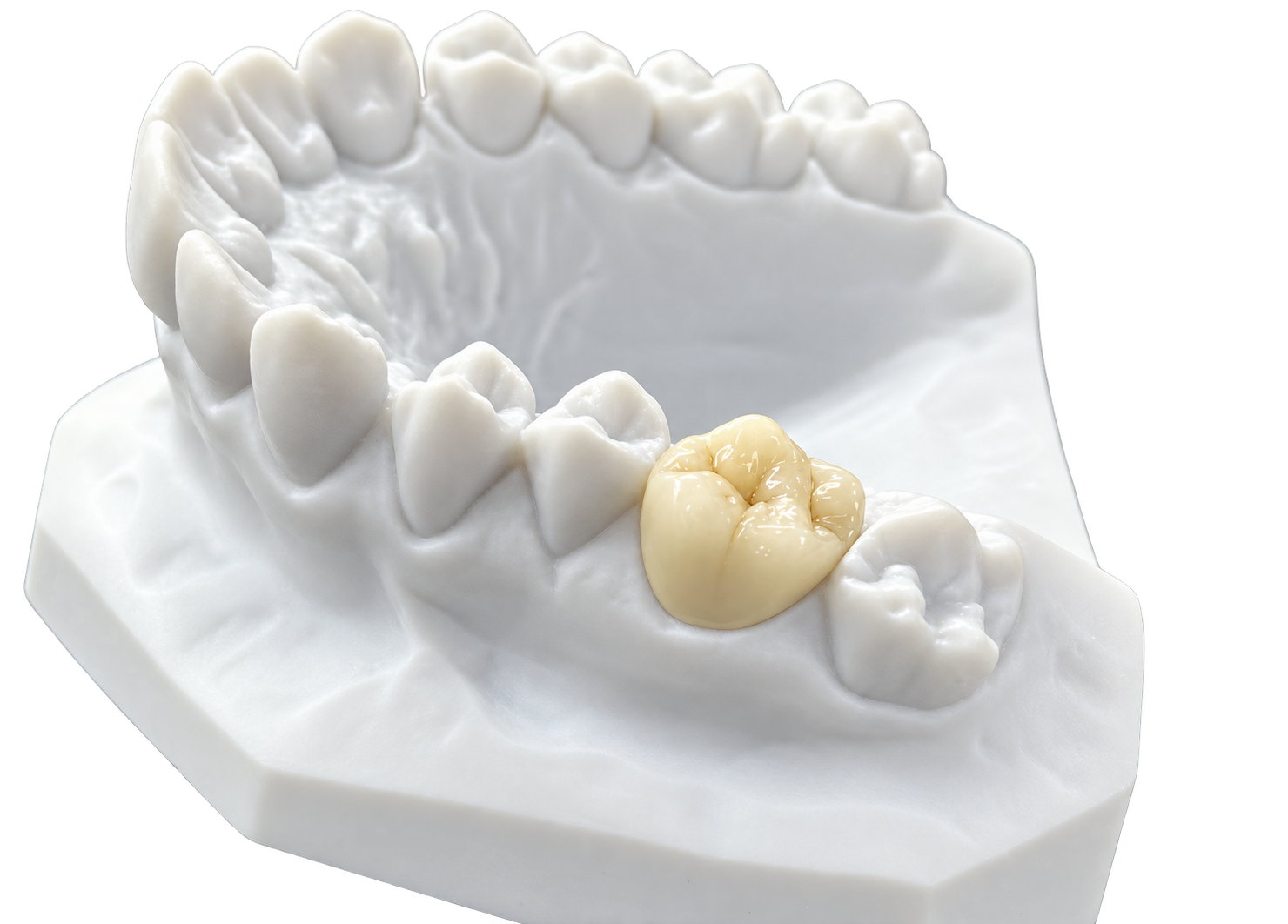 RDL Dental Lab Zirconia Crown product example